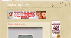 Desktop Screenshot of molesonbody.blogspot.com