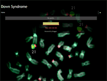 Tablet Screenshot of downsyndromepbio.blogspot.com