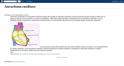 Desktop Screenshot of aneurismacardiaco.blogspot.com