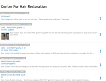 Tablet Screenshot of hairtransplantcentre.blogspot.com