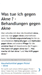Mobile Screenshot of gegen-akne.blogspot.com