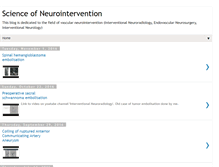 Tablet Screenshot of neurointervention.blogspot.com