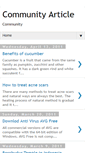 Mobile Screenshot of communityarticle.blogspot.com
