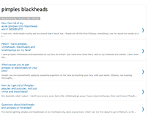 Tablet Screenshot of pimples-blackheads-rt.blogspot.com