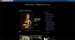 Desktop Screenshot of esteticayprotesisfija.blogspot.com