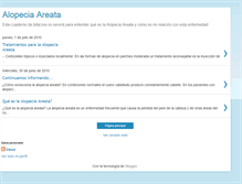 Tablet Screenshot of mialopeciaareata.blogspot.com