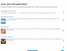 Tablet Screenshot of jenisjenispenyakitkulit.blogspot.com
