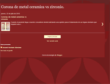 Tablet Screenshot of coronametalceramicavszirconio.blogspot.com