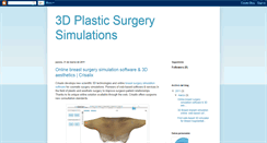 Desktop Screenshot of 3dbreastaugmentationsimulation.blogspot.com