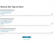 Tablet Screenshot of howtoremoveskintagsathome.blogspot.com