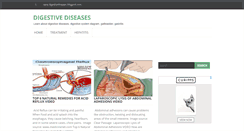 Desktop Screenshot of digestivediseases.blogspot.com