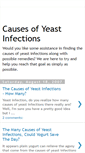 Mobile Screenshot of causesofyeastinfections.blogspot.com