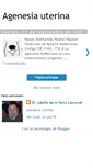 Mobile Screenshot of agenesiauterina.blogspot.com