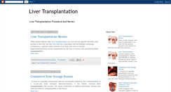 Desktop Screenshot of liver-transplantation.blogspot.com