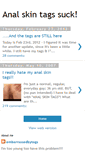 Mobile Screenshot of analskintags.blogspot.com