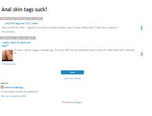 Tablet Screenshot of analskintags.blogspot.com