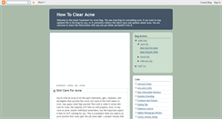 Desktop Screenshot of home-treatment-for-acne.blogspot.com