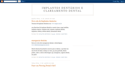 Desktop Screenshot of implantesdentriosclareamentodental.blogspot.com