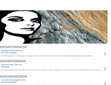 Tablet Screenshot of cervical-dysplasia-1.blogspot.com