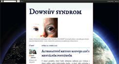 Desktop Screenshot of downuv-syndrom.blogspot.com