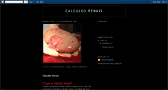 Desktop Screenshot of calculosrenais2009.blogspot.com