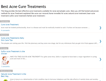 Tablet Screenshot of cureacnetreatments.blogspot.com