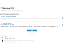 Tablet Screenshot of eczemapedia.blogspot.com
