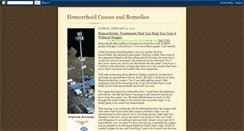 Desktop Screenshot of hemorrhoidcausesandremedies.blogspot.com