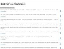 Tablet Screenshot of best-hairloss-treatments-for-me.blogspot.com