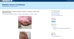 Desktop Screenshot of diabetesinpakistan.blogspot.com