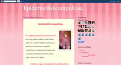 Desktop Screenshot of epidermolisisampollosa.blogspot.com