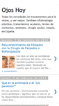 Mobile Screenshot of ojos-hoy.blogspot.com