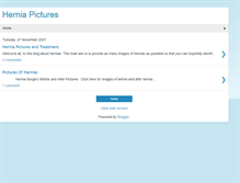 Tablet Screenshot of hernia-pictures.blogspot.com