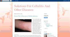 Desktop Screenshot of cellulitis-and-other-diseases.blogspot.com