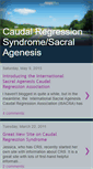 Mobile Screenshot of caudalregression.blogspot.com