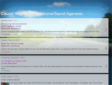 Tablet Screenshot of caudalregression.blogspot.com