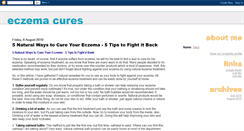 Desktop Screenshot of eczemacures101.blogspot.com