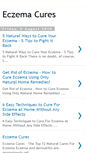 Mobile Screenshot of eczemacures101.blogspot.com