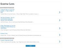 Tablet Screenshot of eczemacures101.blogspot.com