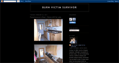Desktop Screenshot of burnvictimsurvivor.blogspot.com