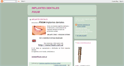 Desktop Screenshot of implantesdentalesarg.blogspot.com