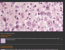 Tablet Screenshot of hhematopatologia.blogspot.com