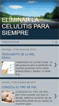 Mobile Screenshot of comoeliminarcelulitisya.blogspot.com