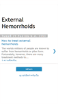 Mobile Screenshot of how-to-treat-external-hemorrhoids.blogspot.com