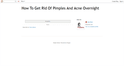 Desktop Screenshot of ihowtogetridofpimplesovernight.blogspot.com