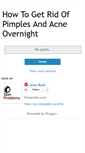 Mobile Screenshot of ihowtogetridofpimplesovernight.blogspot.com