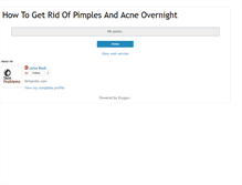 Tablet Screenshot of ihowtogetridofpimplesovernight.blogspot.com