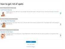 Tablet Screenshot of howtogetridofspotshelp.blogspot.com