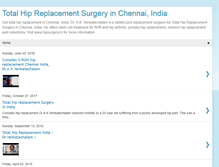 Tablet Screenshot of hipresurfacingmjrcindia.blogspot.com