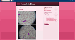 Desktop Screenshot of hematologiatecmedica.blogspot.com